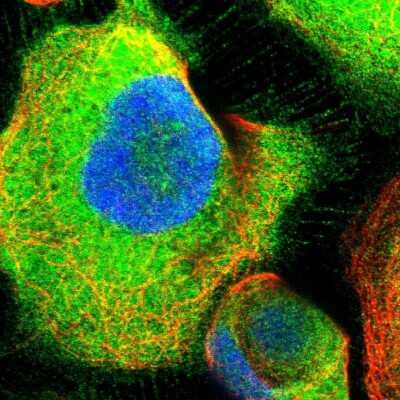 Immunocytochemistry/ Immunofluorescence: ATIC Antibody [NBP1-89192]