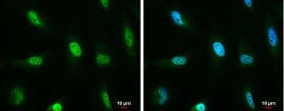 Immunocytochemistry/ Immunofluorescence: ATM Antibody (5C2) [NB100-220]