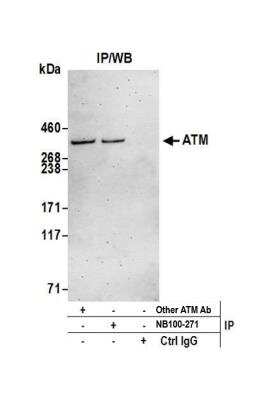 Immunoprecipitation: ATM Antibody [NB100-271]