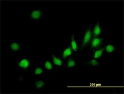 Immunocytochemistry/ Immunofluorescence: ATOX1 Antibody (2E6) [H00000475-M01]
