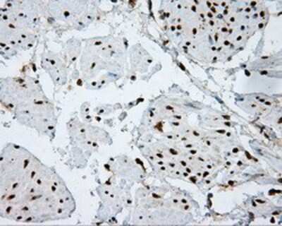 Immunohistochemistry-Paraffin: ATP Citrate Lyase Antibody (OTI3G8) [NBP2-02410]