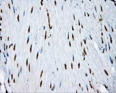 Immunohistochemistry-Paraffin: ATP Citrate Lyase Antibody (OTI3G8) [NBP2-02410]