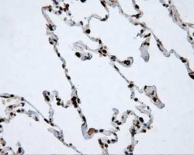 Immunohistochemistry-Paraffin: ATP Citrate Lyase Antibody (OTI3G8) [NBP2-02410]