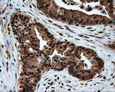 Immunohistochemistry-Paraffin: ATP Citrate Lyase Antibody (OTI3G8) [NBP2-02410]