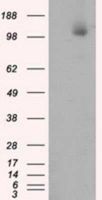 Western Blot: ATP Citrate Lyase Antibody (OTI3G8) [NBP2-02410]