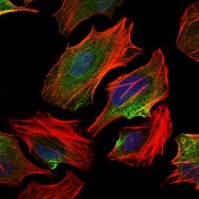 Immunocytochemistry/ Immunofluorescence: ATP Citrate Lyase Antibody (5F8D11) - BSA Free [NBP2-37429]