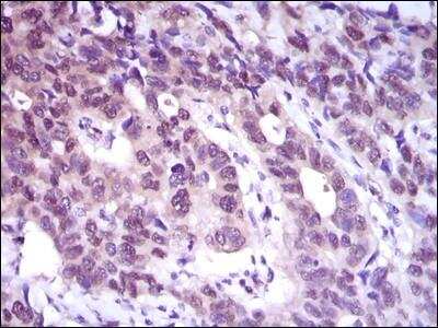Immunohistochemistry-Paraffin: ATP Citrate Lyase Antibody (5F8D11) - BSA Free [NBP2-37429]