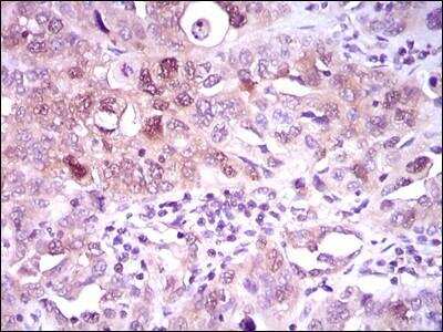 Immunohistochemistry-Paraffin: ATP Citrate Lyase Antibody (5F8D11) - BSA Free [NBP2-37429]