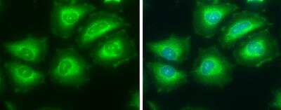 Immunocytochemistry/ Immunofluorescence: ATP Citrate Lyase Antibody [NBP1-33430]