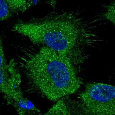 Immunocytochemistry/ Immunofluorescence: ATP Citrate Lyase Antibody [NBP1-90267]
