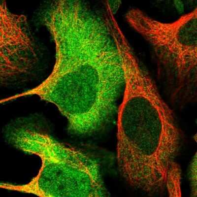 Immunocytochemistry/ Immunofluorescence: ATP Citrate Lyase Antibody [NBP1-90268]