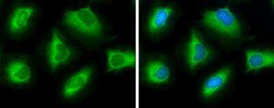 Immunocytochemistry/ Immunofluorescence: ATP Citrate Lyase Antibody [NBP2-15510]