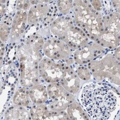 Immunohistochemistry-Paraffin: ATP Citrate Lyase Antibody [NBP1-90266]
