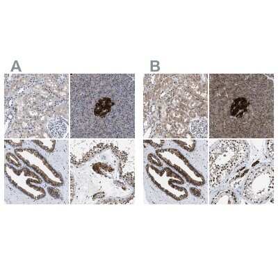 Immunohistochemistry-Paraffin: ATP Citrate Lyase Antibody [NBP1-90266]
