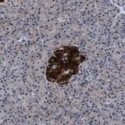Immunohistochemistry-Paraffin: ATP Citrate Lyase Antibody [NBP1-90266]