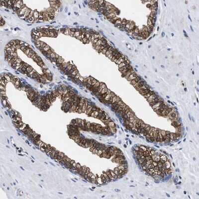 Immunohistochemistry-Paraffin: ATP Citrate Lyase Antibody [NBP1-90266]