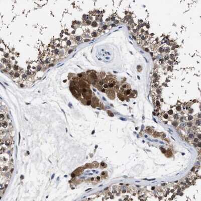 Immunohistochemistry-Paraffin: ATP Citrate Lyase Antibody [NBP1-90266]