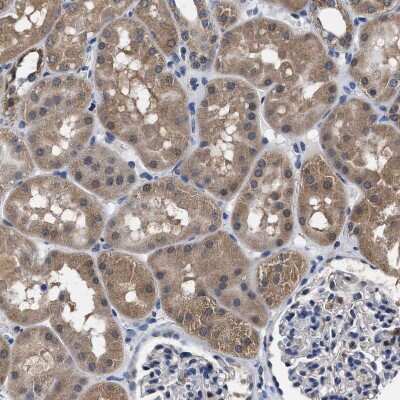 Immunohistochemistry-Paraffin: ATP Citrate Lyase Antibody [NBP1-90267]