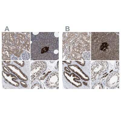 Immunohistochemistry-Paraffin: ATP Citrate Lyase Antibody [NBP1-90267]