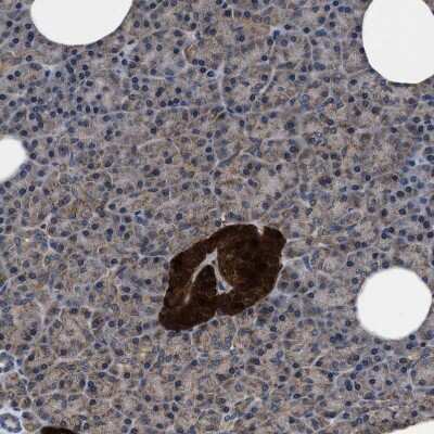 Immunohistochemistry-Paraffin: ATP Citrate Lyase Antibody [NBP1-90267]