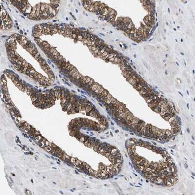 Immunohistochemistry-Paraffin: ATP Citrate Lyase Antibody [NBP1-90267]