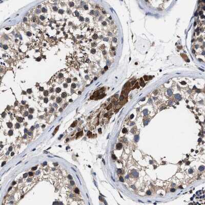 Immunohistochemistry-Paraffin: ATP Citrate Lyase Antibody [NBP1-90267]