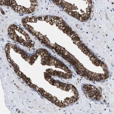 Immunohistochemistry-Paraffin: ATP Citrate Lyase Antibody [NBP1-90268]