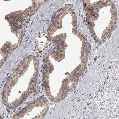 Immunohistochemistry-Paraffin: ATP Citrate Lyase Antibody [NBP1-90269]