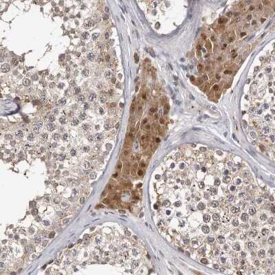 Immunohistochemistry-Paraffin: ATP Citrate Lyase Antibody [NBP1-90269]
