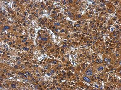 Immunohistochemistry-Paraffin: ATP Citrate Lyase Antibody [NBP2-15510]