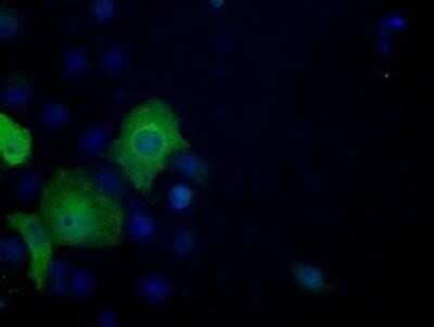 Immunocytochemistry/ Immunofluorescence: ATP Citrate Lyase Antibody (OTI3G8) - Azide and BSA Free [NBP2-70073]