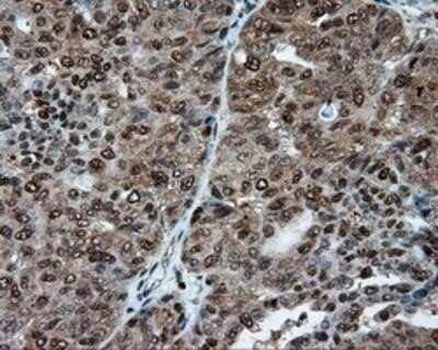 Immunohistochemistry: ATP Citrate Lyase Antibody (OTI3G8) - Azide and BSA Free [NBP2-70073]
