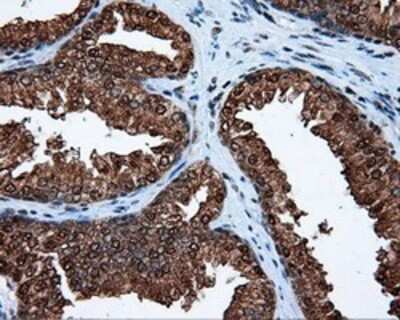 Immunohistochemistry: ATP Citrate Lyase Antibody (OTI3G8) - Azide and BSA Free [NBP2-70073]