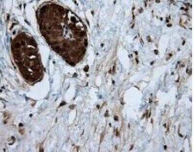 Immunohistochemistry: ATP Citrate Lyase Antibody (OTI3G8) - Azide and BSA Free [NBP2-70073]