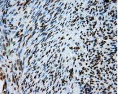 Immunohistochemistry-Paraffin: ATP Citrate Lyase Antibody (OTI3G8) [NBP2-02410]