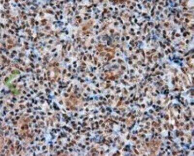 Immunohistochemistry-Paraffin: ATP Citrate Lyase Antibody (OTI3G8) [NBP2-02410]