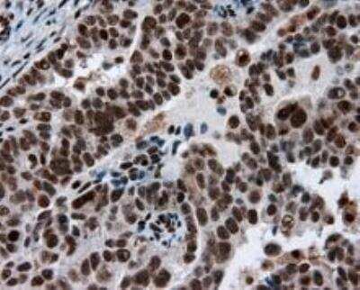 Immunohistochemistry-Paraffin: ATP Citrate Lyase Antibody (OTI3G8) [NBP2-02410]