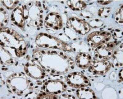 Immunohistochemistry-Paraffin: ATP Citrate Lyase Antibody (OTI3G8) [NBP2-02410]