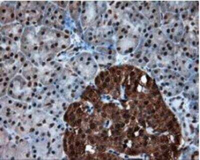 Immunohistochemistry-Paraffin: ATP Citrate Lyase Antibody (OTI3G8) [NBP2-02410]
