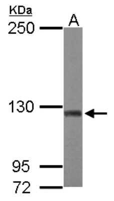 Western Blot: ATP Citrate Lyase Antibody [NBP1-33430]