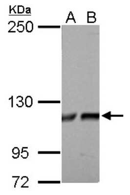 Western Blot: ATP Citrate Lyase Antibody [NBP1-33430]