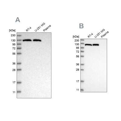 Western Blot: ATP Citrate Lyase Antibody [NBP1-90266]