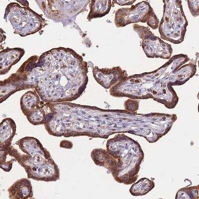 Immunohistochemistry-Paraffin: ATP10D Antibody [NBP2-14327]