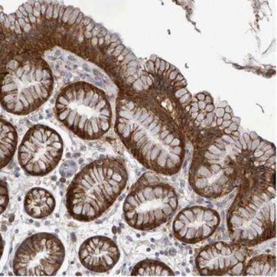 Immunohistochemistry: ATP13A1 Antibody [NBP2-30651]