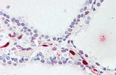 Immunohistochemistry-Paraffin: ATP13A1 Antibody [NB100-93378]