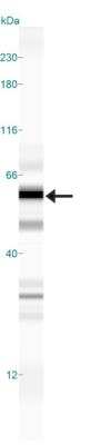 Simple Western: ATP13A2 Antibody [NB110-41486]