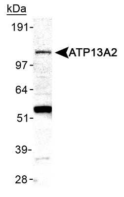 Western Blot: ATP13A2 Antibody [NB110-41486]