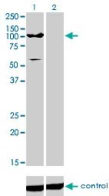Western Blot: ATP2C1 Antibody (2G1) [H00027032-M01]