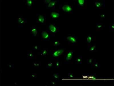 Immunocytochemistry/ Immunofluorescence: ATP2C1 Antibody [H00027032-B01P]