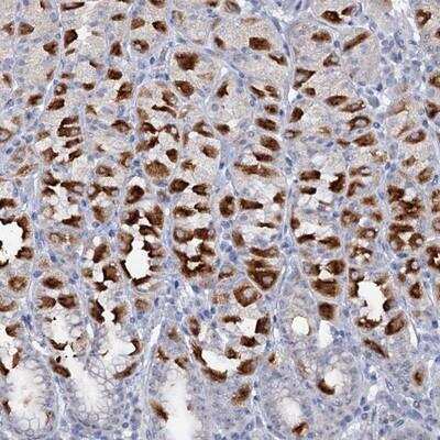 Immunohistochemistry-Paraffin: ATP4A Antibody [NBP1-88889]